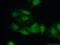 Homeobox D13 antibody, 23520-1-AP, Proteintech Group, Immunofluorescence image 