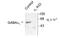 Gamma-Aminobutyric Acid Type A Receptor Alpha1 Subunit antibody, TA309123, Origene, Western Blot image 