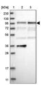 DAB Adaptor Protein 2 antibody, PA5-56005, Invitrogen Antibodies, Western Blot image 