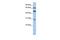 Interferon Induced Protein With Tetratricopeptide Repeats 5 antibody, GTX45363, GeneTex, Western Blot image 