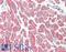 Adenylate Kinase 1 antibody, LS-B8400, Lifespan Biosciences, Immunohistochemistry paraffin image 