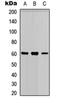 Poly(ADP-Ribose) Polymerase Family Member 3 antibody, orb256742, Biorbyt, Western Blot image 