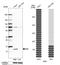 Beta-2-Microglobulin antibody, HPA006361, Atlas Antibodies, Western Blot image 