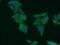 Survival motor neuron protein antibody, 22329-1-AP, Proteintech Group, Immunofluorescence image 