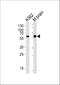 BAI1 Associated Protein 2 antibody, M03306, Boster Biological Technology, Western Blot image 