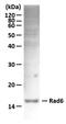 Ubiquitin Conjugating Enzyme E2 A antibody, GTX00885, GeneTex, Western Blot image 
