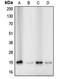 Cofilin 1 antibody, orb213726, Biorbyt, Western Blot image 