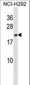 High Mobility Group Box 3 antibody, LS-C164933, Lifespan Biosciences, Western Blot image 