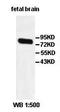 Protocadherin Beta 4 antibody, orb77887, Biorbyt, Western Blot image 