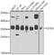 Ubiquitin C-Terminal Hydrolase L5 antibody, GTX55834, GeneTex, Western Blot image 