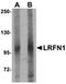 TNF Alpha Induced Protein 3 antibody, orb7102, Biorbyt, Western Blot image 