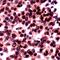 Forkhead Box O3 antibody, PA5-32413, Invitrogen Antibodies, Immunohistochemistry paraffin image 