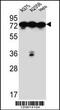 Heat Shock Protein Family A (Hsp70) Member 5 antibody, MBS9211383, MyBioSource, Western Blot image 