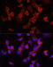 Alpha-1-antitrypsin antibody, 14-451, ProSci, Immunofluorescence image 
