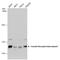 Insulin Receptor antibody, PA5-27334, Invitrogen Antibodies, Western Blot image 