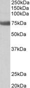 Transglutaminase 6 antibody, 43-151, ProSci, Western Blot image 