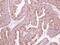 Kelch Like Family Member 2 antibody, PA5-30441, Invitrogen Antibodies, Immunohistochemistry frozen image 