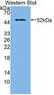 O-6-Methylguanine-DNA Methyltransferase antibody, abx130409, Abbexa, Western Blot image 