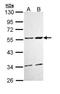 Calcium/Calmodulin Dependent Protein Kinase II Delta antibody, orb73977, Biorbyt, Western Blot image 