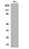 Cyclin-dependent kinase inhibitor 2A, isoform 1 antibody, orb162231, Biorbyt, Western Blot image 