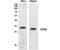 SPARC antibody, STJ96886, St John