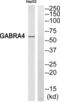 Gamma-Aminobutyric Acid Type A Receptor Alpha4 Subunit antibody, abx014483, Abbexa, Western Blot image 