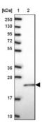 Nuclear Receptor Coactivator 3 antibody, NBP2-32058, Novus Biologicals, Western Blot image 