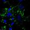 Scavenger Receptor Class B Member 1 antibody, NB400-104, Novus Biologicals, Immunofluorescence image 