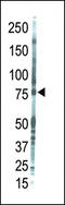 Protein Kinase C Theta antibody, LS-C98934, Lifespan Biosciences, Western Blot image 