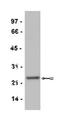 CD3 antibody, AM12005PU-N, Origene, Western Blot image 