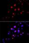 RAD18 E3 Ubiquitin Protein Ligase antibody, LS-C748484, Lifespan Biosciences, Immunofluorescence image 