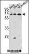 Zinc Finger And SCAN Domain Containing 2 antibody, 56-845, ProSci, Western Blot image 