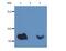 Beta-2-Microglobulin antibody, NBP1-44521, Novus Biologicals, Western Blot image 