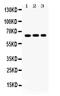 Cryptochrome Circadian Regulator 1 antibody, PB9540, Boster Biological Technology, Western Blot image 