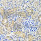 ANTXR Cell Adhesion Molecule 2 antibody, A6526, ABclonal Technology, Immunohistochemistry paraffin image 
