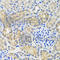 Anthrax toxin receptor 2 antibody, A6526, ABclonal Technology, Immunohistochemistry paraffin image 