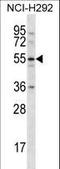 C-Type Lectin Domain Family 18 Member A antibody, LS-C168832, Lifespan Biosciences, Western Blot image 