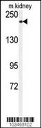 Transient Receptor Potential Cation Channel Subfamily M Member 7 antibody, MBS9214600, MyBioSource, Western Blot image 