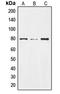 Notch Receptor 2 antibody, LS-C352593, Lifespan Biosciences, Western Blot image 