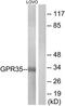 G Protein-Coupled Receptor 35 antibody, TA313953, Origene, Western Blot image 