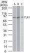 Toll Like Receptor 1 antibody, TA336407, Origene, Western Blot image 