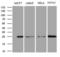 Translin antibody, LS-C794776, Lifespan Biosciences, Western Blot image 