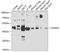 StAR Related Lipid Transfer Domain Containing 3 antibody, A05385, Boster Biological Technology, Western Blot image 