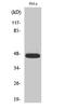 Caspase 9 antibody, STJ90758, St John