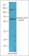 Acid Sensing Ion Channel Subunit Family Member 4 antibody, orb155571, Biorbyt, Western Blot image 