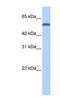 Target Of EGR1, Exonuclease antibody, NBP1-53158, Novus Biologicals, Western Blot image 