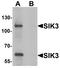 SIK Family Kinase 3 antibody, LS-B9603, Lifespan Biosciences, Western Blot image 
