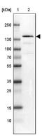 Timeless Circadian Regulator antibody, PA5-63886, Invitrogen Antibodies, Western Blot image 