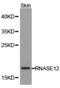 Ribonuclease A Family Member 12 (Inactive) antibody, LS-C192981, Lifespan Biosciences, Western Blot image 