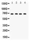G Protein-Coupled Receptor Kinase 5 antibody, PA5-79331, Invitrogen Antibodies, Western Blot image 